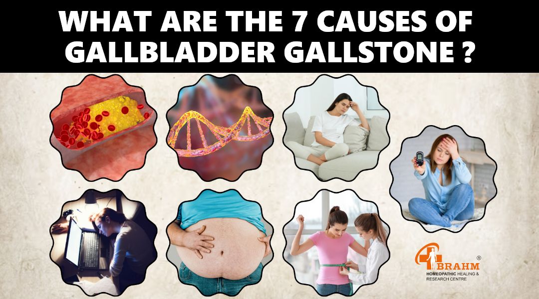 What-are-the-7-causes-of Gallbladder-Gallstone